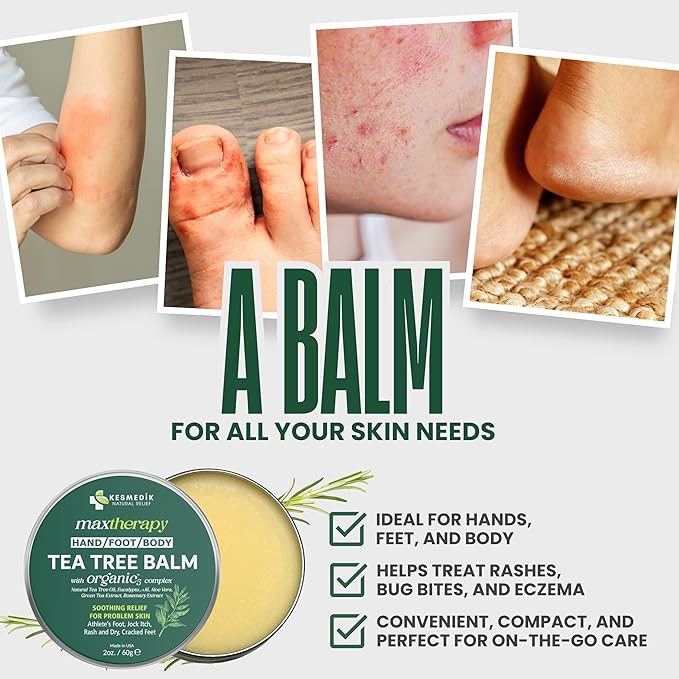 KESMEDIK Tea Tree Oil Balm for Skin, Soothes Itching, Rashes & Dry Skin, Antifungal Defense for Athlete’s Foot, Jock Itch, Chafing, Bug Bites & Eczema, Natural, Effective & Safe for All Ages, 2-Pack