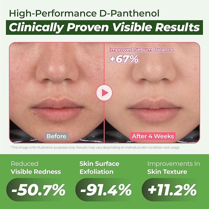 JUMISO D-Panthenol Hydrating Serum – 10 Types Hyaluronic Acid for Oily Dehydrated Sensitive Skin – Cooling Watery Texture, Non-Sticky, BHA + Niacinamide Pore Care – Fragrance-Free, Jumbo 2.37 fl oz