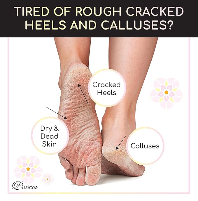 Prescia Foot Peel Mask - For Cracked Heels, Dead Skin & Calluses - Baby Soft Feet, Smooth Skin, Removes & Repairs Rough Heels, Dry Toe Skin - Exfoliating Peeling Natural Treatment - Crescena