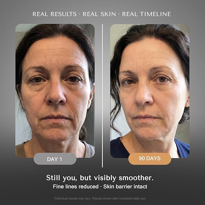 Retinol Serum for Face Wrinkles – Skin Renewing Day & Night System (2 x 30 ml) – Anti Aging Skin Booster Serum, Moisture-Locking Duo for Eyes, Neck & Deep Lines