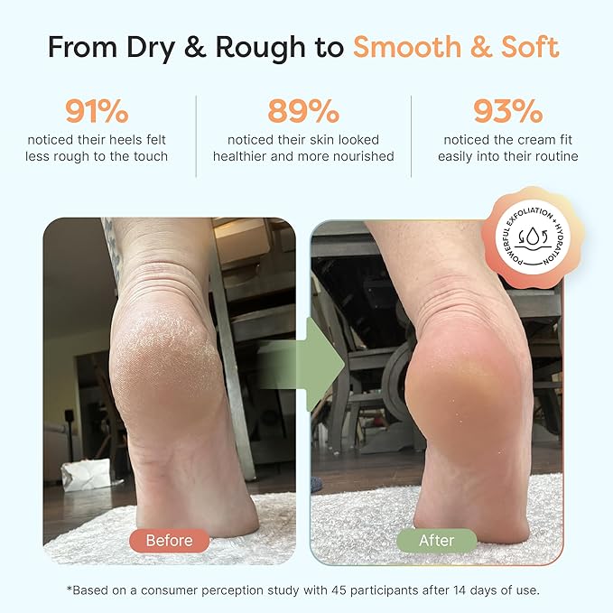 ZenToes Urea Cream 40 Percent for Feet | Foot Lotion for Dry Cracked Heels and Feet | Intense Dry Feet Softening and Hydration for Skin | Heel Balm and Moisturizing Care | 5oz, Pack of 2