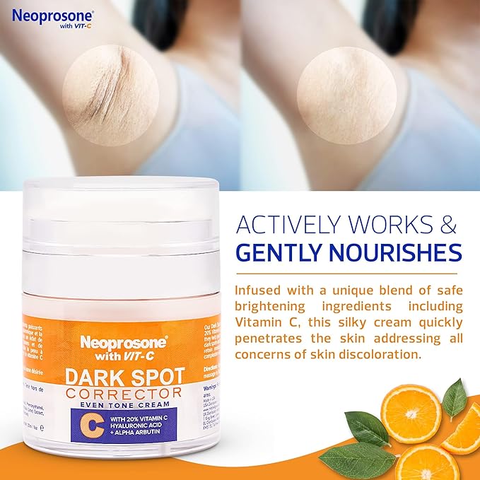 NEOPROSONE 20% Vitamin C Dark Spot Corrector Cream - 1 Fl oz / 30ml - Skin Brightening Gel Cream - with Hyaluronic Acid, Vitamin E