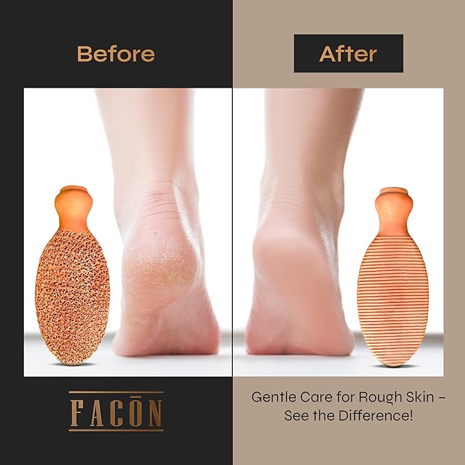 Facón Pumice Stone for Feet Callus Remover - Terra-Cotta Foot Scrubber with 2 Sides, 100% Pure Natural Foot Pumise Stone, Pedicure Pumice Stone Scrubber, Foot Exfoliator, Removes Calluses & Dead Skin