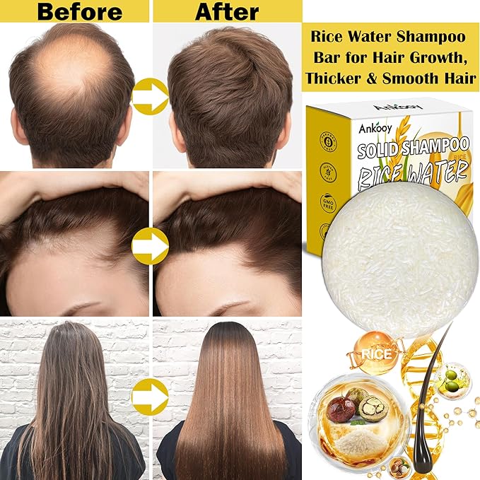 2 Pack Rice Water Shampoo Bar for Hair Growth,Deep Cleansing Rice Shampoo Bars,Solid Soap for Women and Men,Reduce Breakage,Anti Hair Loss,Boosts Shine -Paraben/Silicone & Sulfate-Free,Vegan Hair Care