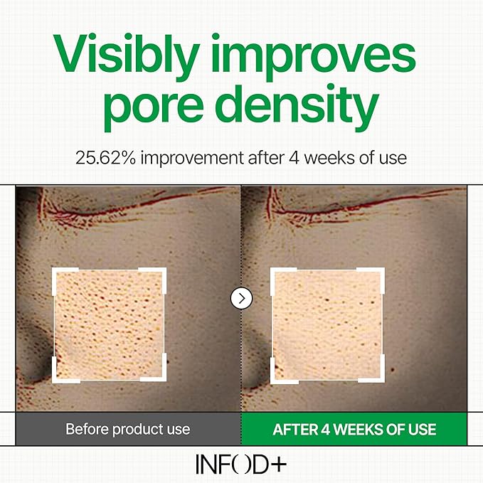INFODPLUS Vitamin Hydrogel Toner Pads for Face, Pore Minimizing, Dark Spots, Oil Control, Calming, Hydrating with Ceramide and Exosome, Daily Exfoliating for Sensitive Skin, Korean Skincare 70 Counts