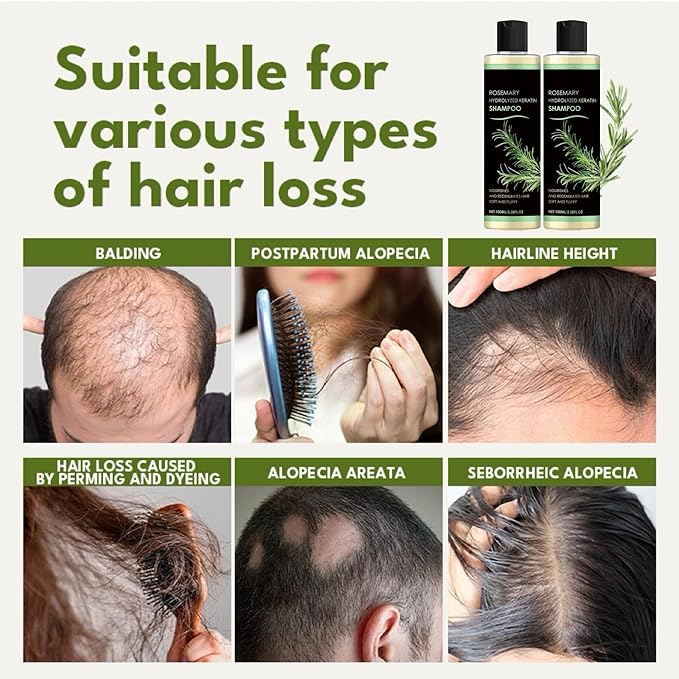 Rosemary Hair Growth Shampoo, Rosemary Hydrolyzed Keratin Shampoo for Thinning Hair and Hair Loss, Nourishes and Regenerates Hair for Women and Men (2Pcs)