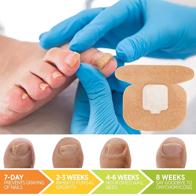 Small Nail Patches Extra Strength: 32 PCS Nighttime Hydrogel Patches for Overnight Repair - Visible Results in 8 Hours - Toenail Extra Strength