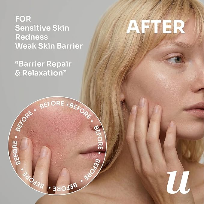 uLOOK Barrier Repair Serum 30 mL / 1.01 fl oz – Ectoin, Ceramide NP & Hyaluronic Acid Complex – Moisture Support & Skin Barrier Care – Flora Friendly