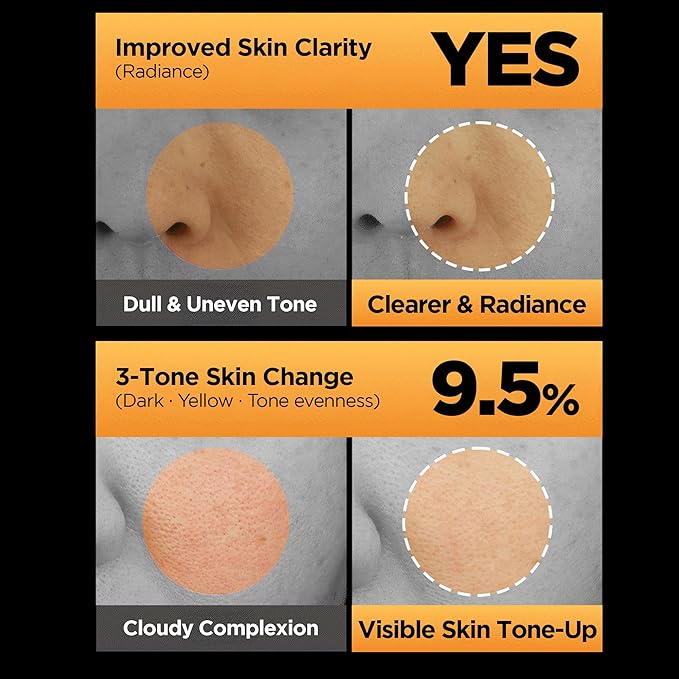 WELLAGE Hyper Toning Glowy Ampoule for face, korean skin care, glutathoine, vitamin c, spot correcting, blemishes skin, acne scars, tone up skin, 1.01 fl.oz