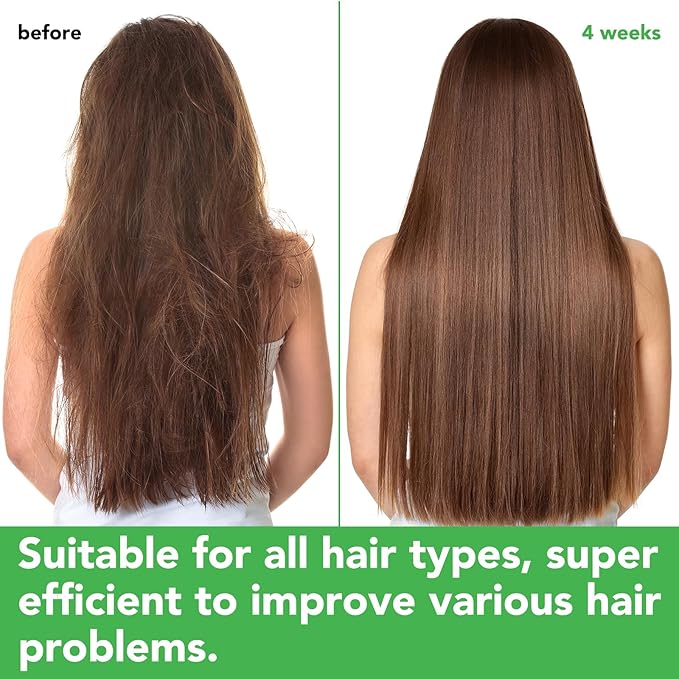 Rosemary Mint Shampoo and Conditioner set Infused with Biotin Promotes Hair Growth & Scalp Health, Strengthen Weak and Brittle Hair for All Hair Types