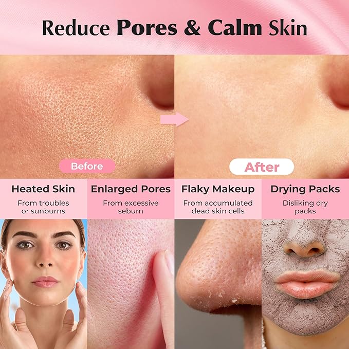 APERIRE White Clay Pore Mask, Deep Cleansing & Sebum Control Treatment, Minimizes Pores & Blackheads for Oily Acne-Prone Skin, Korean Skincare, 4.23 oz