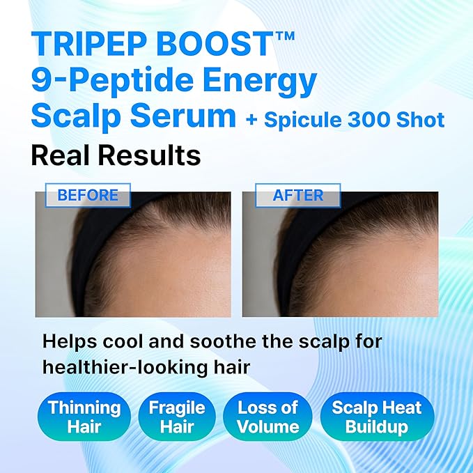 9-Peptide Hair Growth Scalp Care Serum 1.35 Oz(2X Size) - Rosemary 2% Caffeine 1% PDRN & Spicule 300 Roll-On Type | Thicker Fuller-looking Hair w/Niacinamide Zinc PCA | Thinning hair Korean Haircare