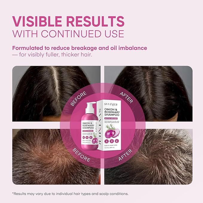 Svvimer Onion Rosemary and Biotin Shampoo - Hair Growth Shampoo for Hair Loss and Thinning - Thickening and Strengthening Formula for Men & Women Sulfate Free 13.5 Fl Oz (Pack of 1)