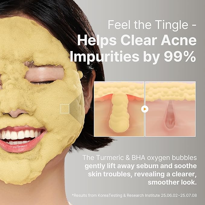 P.CALM Turmeric Bubble Deep Mask | Dark Spot Corrector with AHA/BHA, Carbonated Water Soothes Redness & Evens Skin Tone, Clay Wash-Off Pack | Korean Skincare, 90g / 3.17 oz