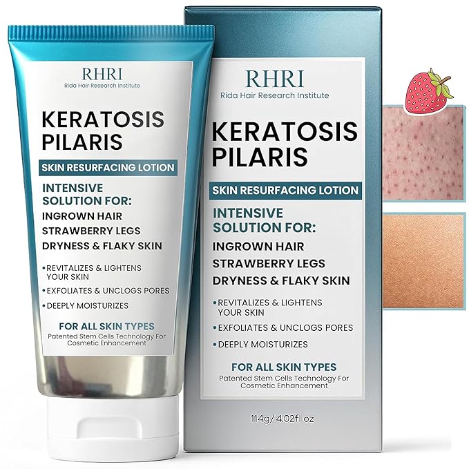 Keratosis Pilaris Treatment | Keratosis Pilaris Lotion with 10% AHA | Gentle Exfoliation For Strawberry Legs, KP & Ingrown Hairs | Smooth & Hydrating Body Lotion For Redness, Dry, Rough And Flaky Skin