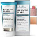 Keratosis Pilaris Treatment | Keratosis Pilaris Lotion with 10% AHA | Gentle Exfoliation For Strawberry Legs, KP & Ingrown Hairs | Smooth & Hydrating Body Lotion For Redness, Dry, Rough And Flaky Skin