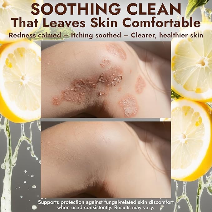 Antifungal Soap with Lemon Oil | Medicated Jock Itch Treatment Helps Fight Ringworm & Athlete’s Foot | Tolnaftate 1% Antifungal Cleansing Bars with Scrubber Infused with Sweet Orange & Grapefruit Oil