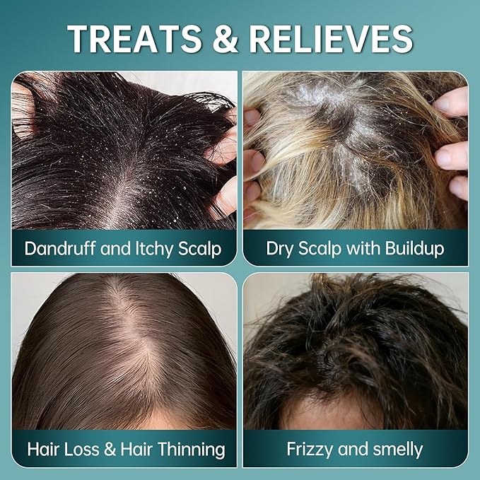 Sea Salt Cleansing Scalp Scrub & Exfoliating Shampoo - for Itchy、Dandruff Scalp with Excess Oil and Buildup | Gently Soothes & Care Hair and Scalp with Rosemary Oil、Coconut Oil & Shea Butter