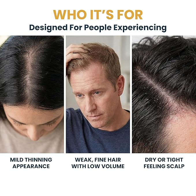 Copper Peptide Serum for Hair Growth - Caffeine, Niacinamide, Rosemary Oil, Saw Palmetto Hair Density Serum, Topical Tripeptide Scalp Care for Hair Thinning, Women & Men 1 fl oz