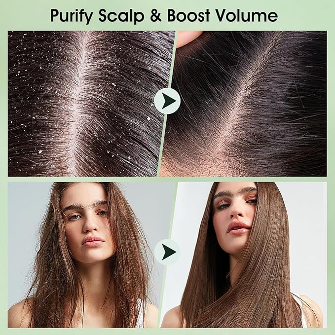 VOERUY Scalp Scrub, Tea Tree Scalp Exfoliator Scrub Shampoo, 2-in-1 Scalp Treatment with Mint Oil, Hair Treatment to Clarify and Remove Build up with Silicone Scalp Massager, 10.6oz/300g