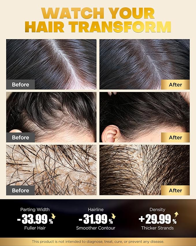 Tripeptide-Infused Biotin Hair Growth Shampoo and Conditioner Set, Onion Anti-Loss Volumizing Moisturizing Treatment for Soft Shine Hair, Dandruff Routine Shampoo for Men and Women, 2x16.9oz
