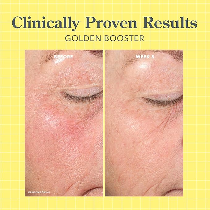 Beekman 1802 Golden Booster Amla Berry Face Serum – Vitamin C Alternative Brightening Serum – Helps Even Tone & Reduce the Look of Dark Spots – Sensitive Skin Safe – 0.5 fl oz