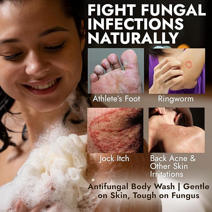Antifungal Body Wash with Tea Tree Oil & Lemon Oil | 1% Tolnaftate Soap Helps Fight Ringworm, Jock Itch & Athlete’s Foot | Itch & Odor Relief | Medicated Citrus Body Wash for Men & Women | 16.9 oz