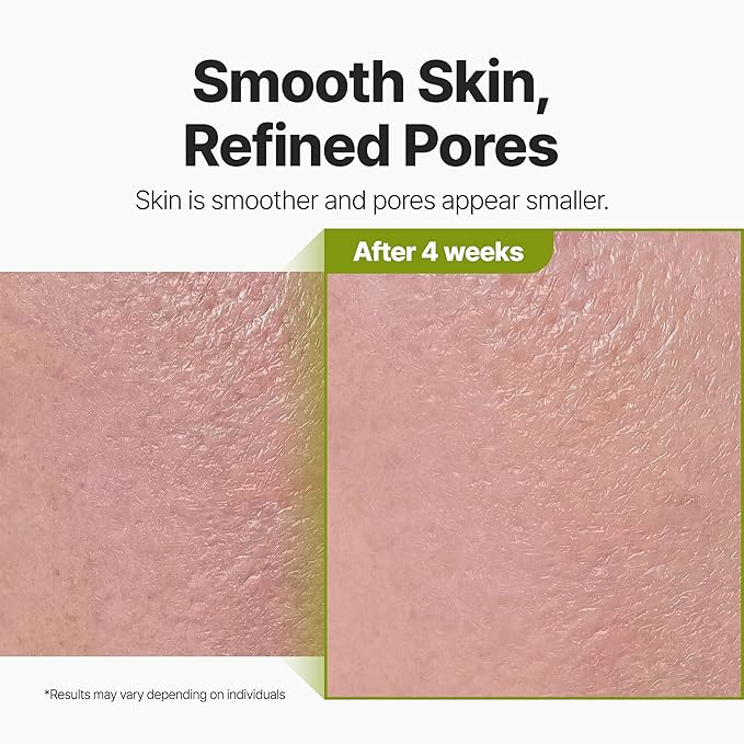 P.CALM Holy Basil Bubble Deep Mask | Blackhead Removal & Pore Cleansing, Purifying Clay Wash-Off Pack, Carbonated Water, for Sensitive Skin | Korean Skincare, 90g / 3.17 oz