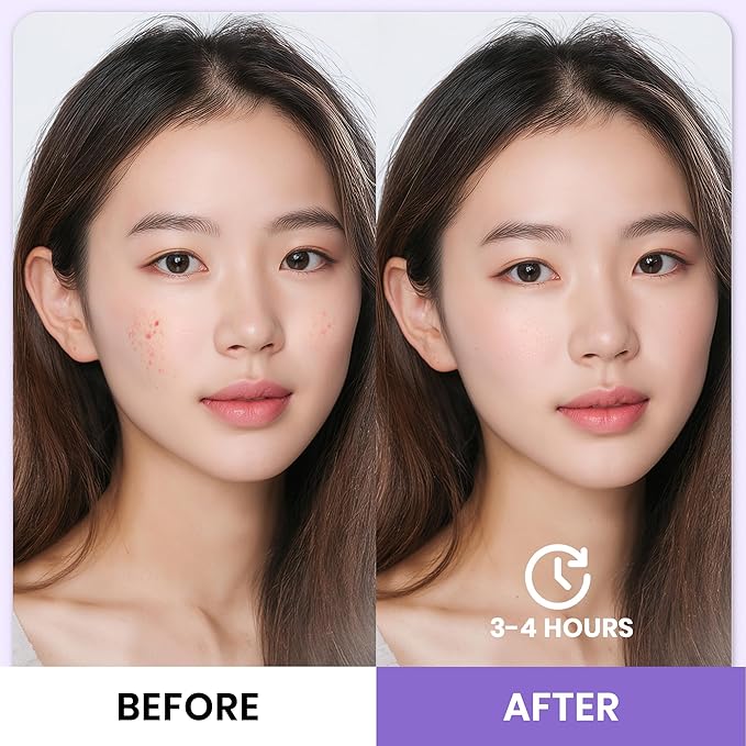 Deep Collagen Overnight Face Mask | Hydrating Anti Aging Gel Mask for Fine Lines Wrinkles & Firming | Pore Tightening Moisturizing Facial Treatment for All Skin Types
