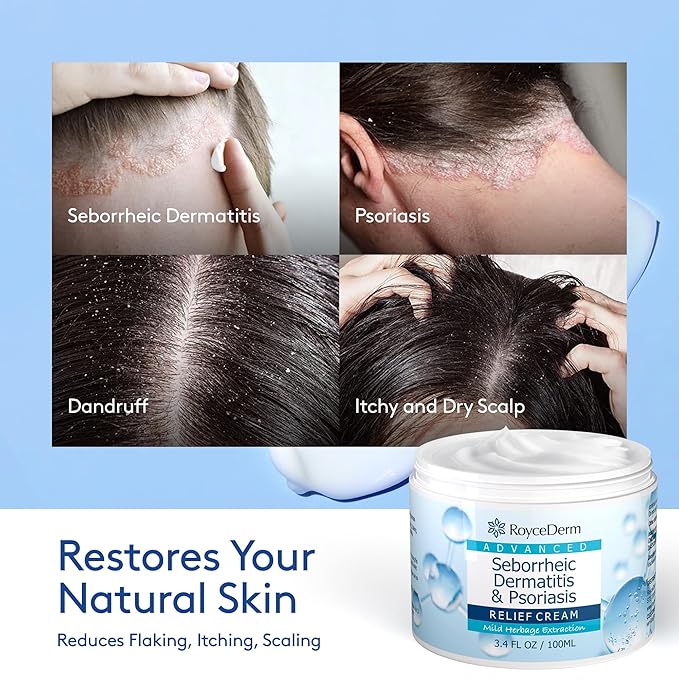 Roycederm Seborrheic Dermatitis & Psoriasis Scalp Treatment Kit – Shampoo + Cream for Dry Itchy Scalp, Dandruff, Scalp Relief Soothing Care System