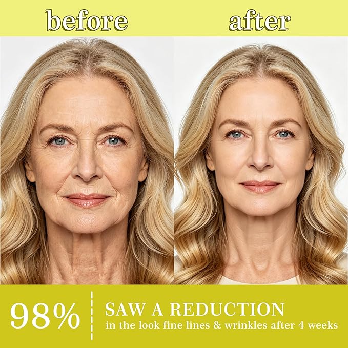 Botoxmix & Vita A Retinal Shot Tightening Booster | Wrinkle-Lift Tightening Cream, Collagen Lifting Serum, Retinoid for Anti-Aging, Pore Minimizer, Wrinkles & Fine Lines, Firmer Skin (15ml x 2 PCS)