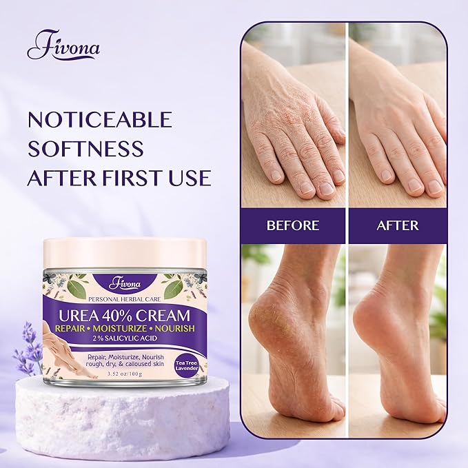 FIVONA 40% Urea Foot Cream for Dry Cracked Heels - Extra Strength Callus Softening Cream with 2% Salicylic Acid, Tea Tree & Lavender, 100g (3.5 oz)