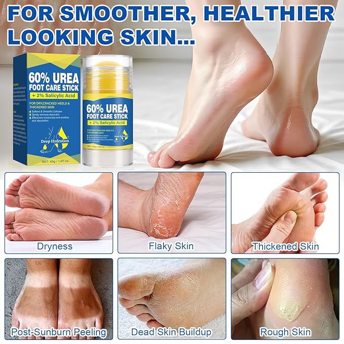 60% Urea Cream Stick for Feet with 2% Salicylic Acid, Maximum Strength Foot Cream for Dry Cracked Heels, Callus Remover for Feet, Hands, Knees & Elbows, Fast Absorbing Foot Balm 1.41oz (2 Pack)