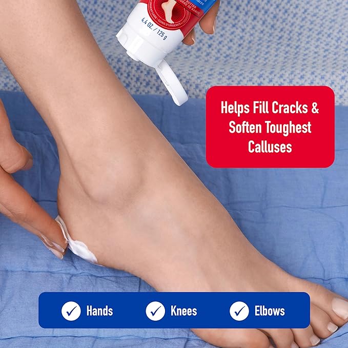 Heal&Rescue Heel Rescue Super Crack Foot Cream, Concentrated AHA Blend & Shea Butter, Moisturizes, Exfoliates, Softens & Aids Cracked Heel Repair, 4.4 Ounce