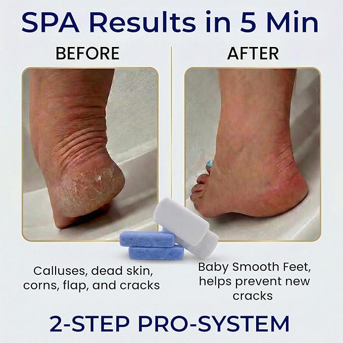 Earth & I Pumice Stone for Feet – 6-Pack Callus Remover Set | 3 Coarse + 3 Fine Dual-Grit Dead Skin Scrubber & Heel Exfoliator for Baby-Soft Feet