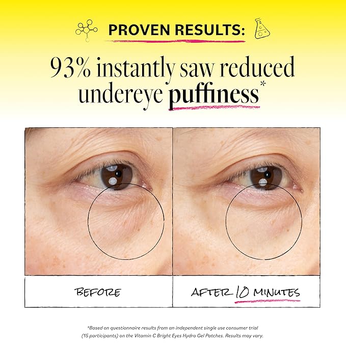 Derma E Vitamin C Bright Eyes Hydro Gel Under Eye Patches for Dark Circles (10 Ct, 5 Pairs) Allantoin, Caffeine & Vitamin B3, Eye Patches for Fine Lines, Wrinkles, Dark Circles & Puffy Eyes