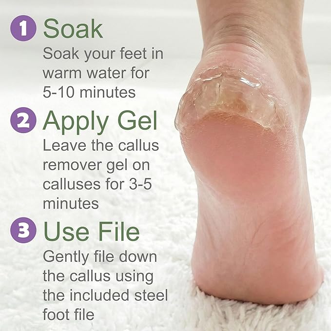 Callus Remover Gel & Double-Sided Foot File: 8 oz Extra Strength Callus Remover for Feet, Foot Callus Remover Care, Pedicure Tools Supplies, Spa Kit, Dead Skin Scrubber
