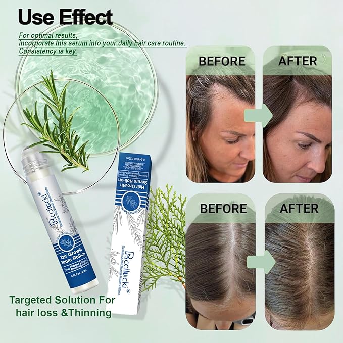 2PCS Rosemary Hair Growth Serum Roll-On, 25ml - With Polygonum Multiflorum, Platycladus Orientalis, Angelica Root, Aloe & Rosemary - Promotes Thicker, Fuller Hair, Non-Greasy Formula for Men