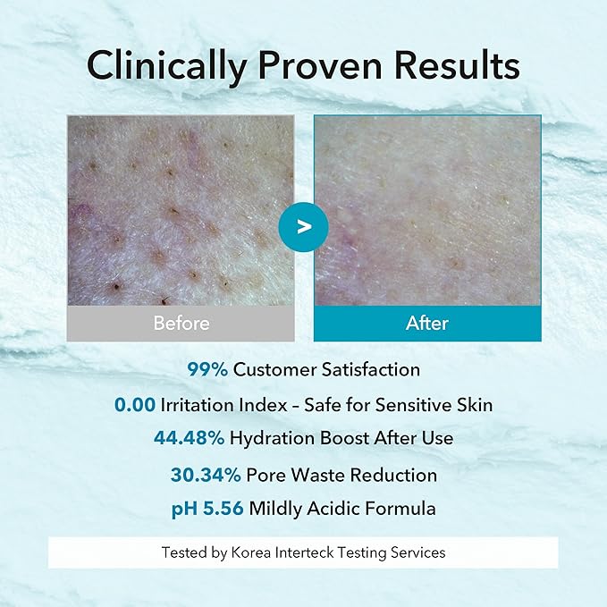 Hyaluronic Aquaporin Pack Cleanser, Hydrating Gentle Face Wash for Dry & Sensitive Skin, Korean Skincare, 5.07 fl oz / 150 ml