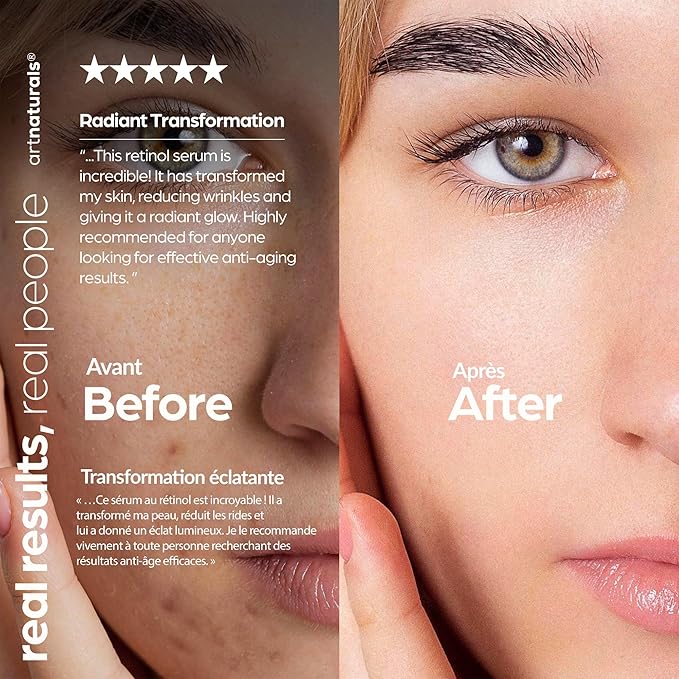 ArtNaturals Retinol Serum for Face - with Vitamin C, Retinol Oil & Hyaluronic-Acid - Skin Clearing - Anti-Aging, Anti-Wrinkle Eye Serum - Skin Repair, Night Therapy (1 Fl Oz / 30ml) (ANGA-0127)
