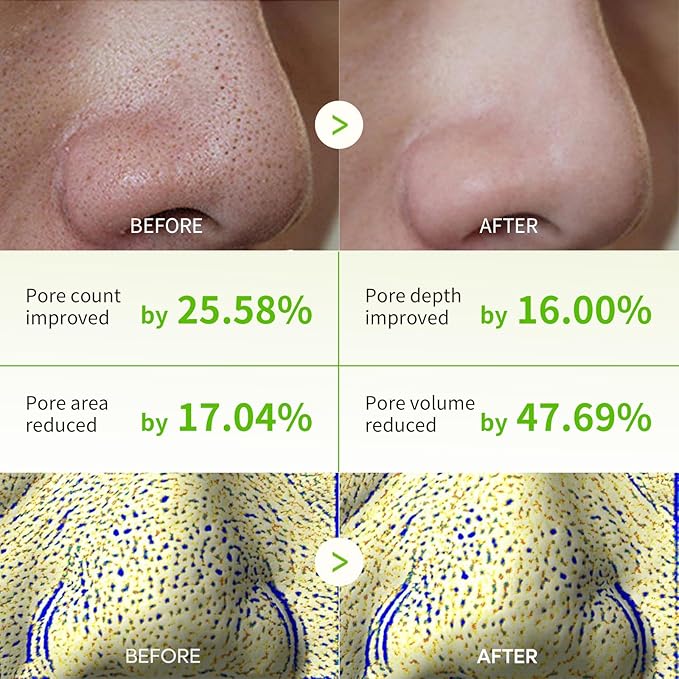 Nose Pore Strips, Blackhead Remover Mask Cactox 3 Step Nose Mask Pack with AHA and PHA for Sebum Softening Pore Tightening Skin Repair 3-Step Nose Pore 3 pack