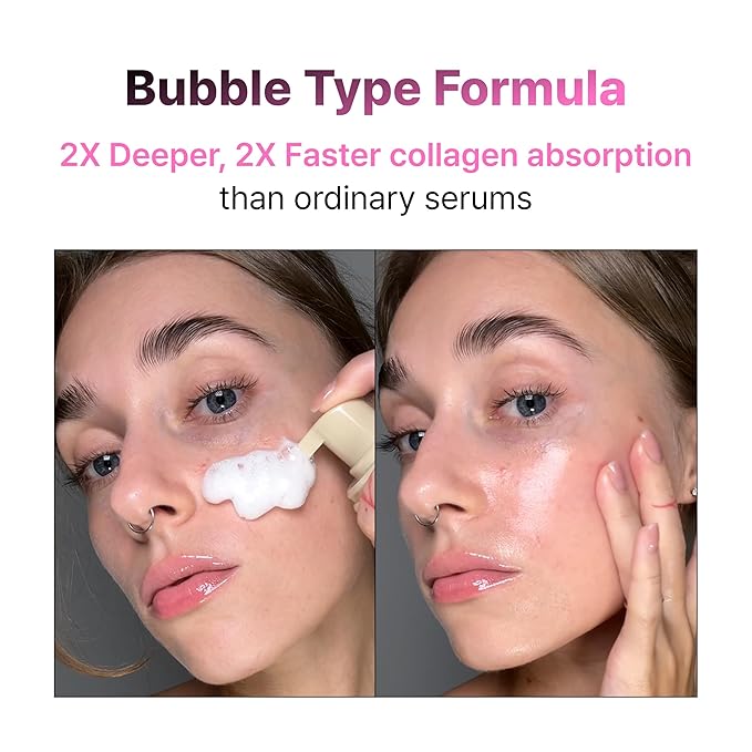 [PODL] Collagen Bubble Serum for Skin Elasticity Radiance Glow | Firming Hydrating Exfoliating Fast Absorbing Serum | K-Chestnut Collagen Niacinamide | No Fragrance 3.88 fl oz Korean Skincare