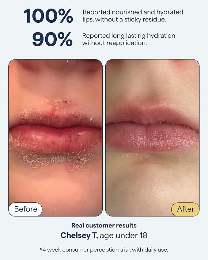 Remedy for Dry Lips | All-In-One Lip Treatment | Hydrating and Healing Lip Balm Ointment with Ceramides, Peptides, and Dimethicone | Repairs Dry, Cracked Lips | By Dermatologist Dr. Shah