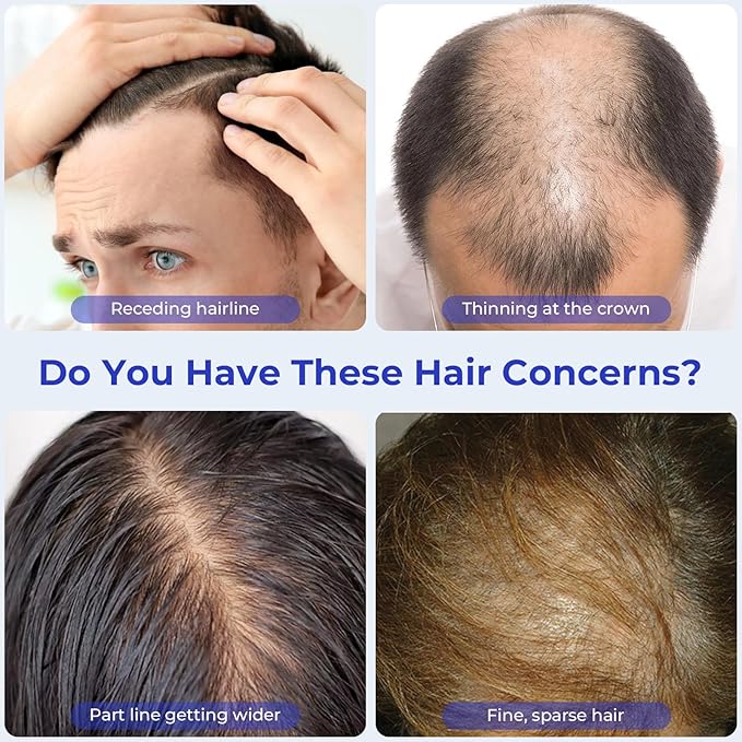 Rosemary Oil Hair Growth Serum Roll On – 3% Rosemary Oil, 2% Caffeine, 2% Niacinamide & DHT Blocking Complex, Non-Greasy Scalp Serum for Men & Women, Designed for Thinning, Fine & Weak Hair
