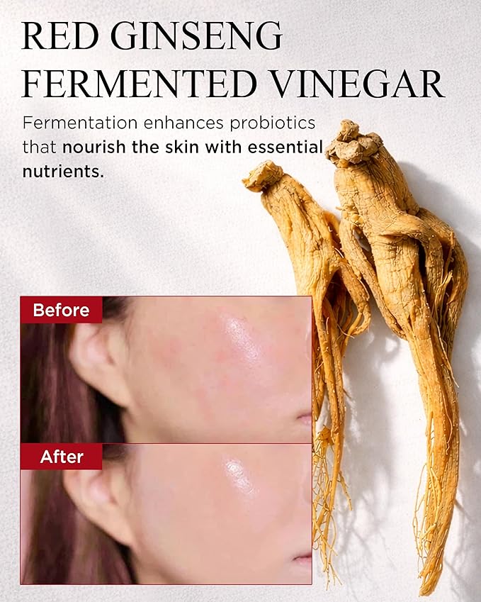 DANAHAN Korean Red Ginseng Vinegar Toner for Dry & Mature Skin - Rich Hydrating Essence with 6-Year Fermented Ginseng + Niacinamide + Adenosine for Glass Skin Glow, Bonyongo Hanbang, 5.07 fl oz