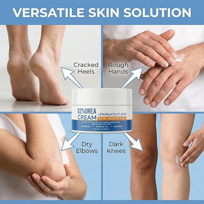 Grospe Urea Cream 62% with 2% Salicylic Acid Foot Cream for Dry Cracked Heels Feet Intensive Callus Remover Exfoliating Hand Cream for Rough Knees Elbows Dead Skin Remover Moisturizer Lotion, 2 Pack