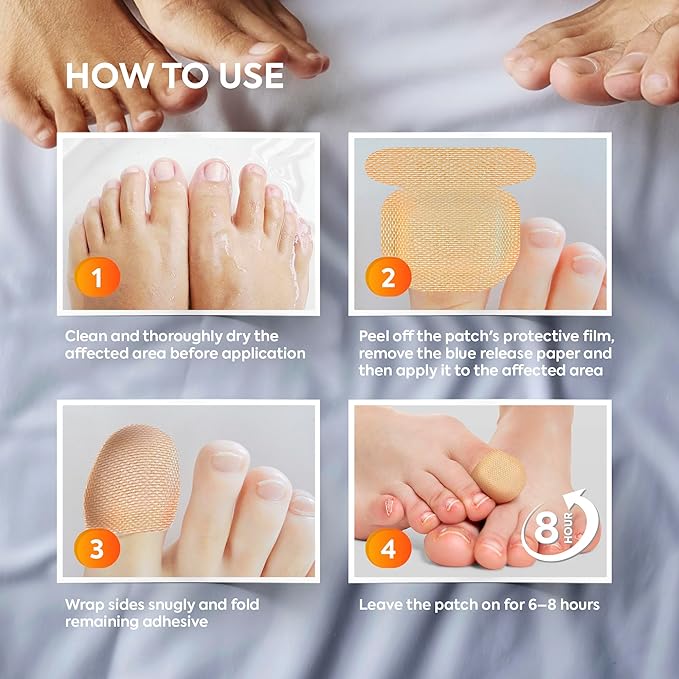 Toenail Fungus Treatment Extra Strength: Nail Fungus Treatment Patches for Toenail and Fingernails - 8-Hour Nighttime Renewal with 1% Tolnaftate - 32 Patches