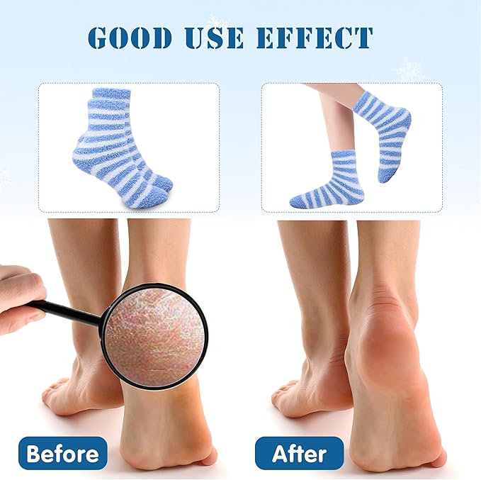 3 Pairs Aloe Socks Moisturizing Spa Socks for Dry Cracked Feet, Sleeping Fuzzy Socks Non Slip Lotion Socks for Women Men Spa, Foot Care Socks for Repairing Softening Dry Cracked Heel