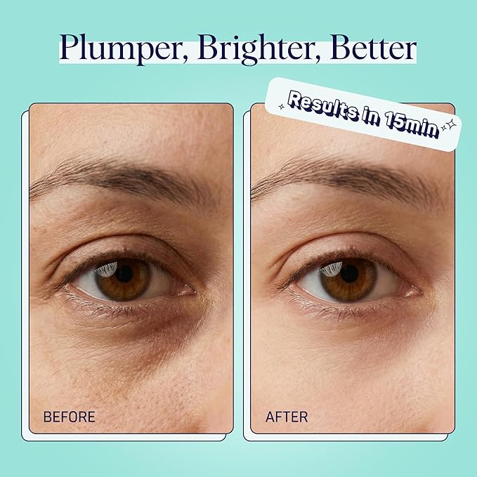 SpaLife Cooling Cucumber Eye Pads | Spa Gifts & Korean Dark Circles & Puffy Eyes Treatment | Nourishing Cucumber Eye Pads | Eye Mask for Puffy Eyes Daily Depuffing Eye Patches | 4 Packs of 12