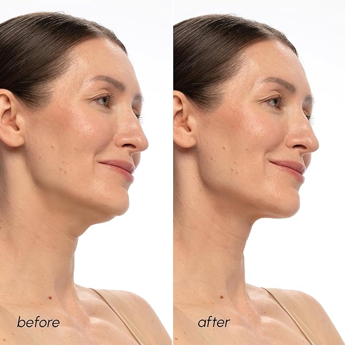 MAREE V Line Lifting Mask with PDRN Salmon DNA – Deep Collagen Face Mask for Women – Jawline Shaper Facial Masks with Retinol – Tightening & Firming Neck Lift Tape – Double Chin Strap for Face Lift